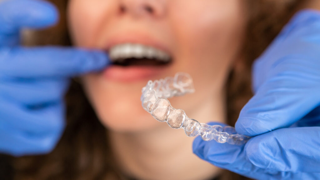 Invisalign-aligners-while-they-are-under-the-care-of-dentists