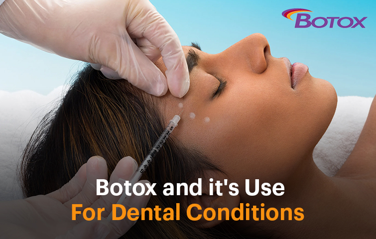 botox and its use